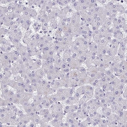 Invitrogen AKAP5 Polyclonal Antibody 100 &mu;L | Buy Online | Invitrogen&trade; | Fisher Scientific