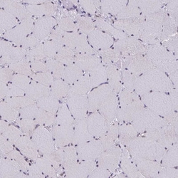 Invitrogen AKAP5 Polyclonal Antibody 100 &mu;L | Buy Online | Invitrogen&trade; | Fisher Scientific