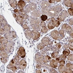 Invitrogen TMCC1 Polyclonal Antibody 100 &mu;L | Buy Online | Invitrogen&trade; | Fisher Scientific