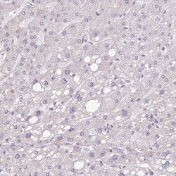 Invitrogen Hemicentin 2 Polyclonal Antibody 100 &mu;L | Buy Online | Invitrogen&trade; | Fisher Scientific