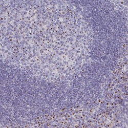 Invitrogen VKORC1L1 Polyclonal Antibody 100 &mu;L; Unconjugated:Antibodies,