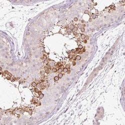 Invitrogen LDHAL6B Polyclonal Antibody 100 &mu;L; Unconjugated:Antibodies,