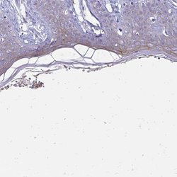 Invitrogen EVPL Polyclonal Antibody 100 &mu;L | Buy Online | Invitrogen&trade; | Fisher Scientific