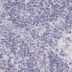 Invitrogen KRT25 Polyclonal Antibody 100 &mu;L; Unconjugated:Antibodies,