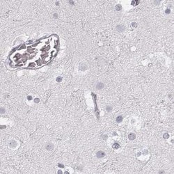 Invitrogen KRT25 Polyclonal Antibody 100 &mu;L; Unconjugated:Antibodies,