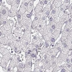 Invitrogen KRT25 Polyclonal Antibody 100 &mu;L; Unconjugated:Antibodies,