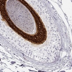 Invitrogen KRT25 Polyclonal Antibody 100 &mu;L; Unconjugated:Antibodies,