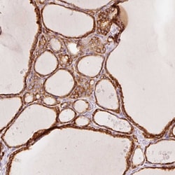Invitrogen OR13C3 Polyclonal Antibody 100 &mu;L; Unconjugated:Antibodies,