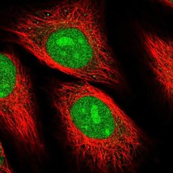Invitrogen C20orf43 Polyclonal Antibody 100 &mu;L; Unconjugated:Antibodies,