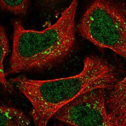 Invitrogen TMEM184C Polyclonal Antibody 100 &mu;L; Unconjugated:Antibodies,