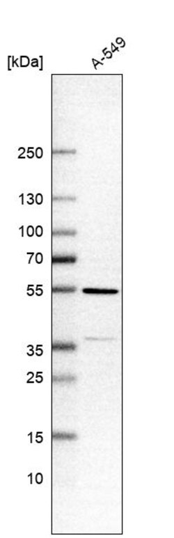 Invitrogen TMEM246 Polyclonal Antibody 100 &mu;L | Buy Online | Invitrogen&trade; | Fisher Scientific