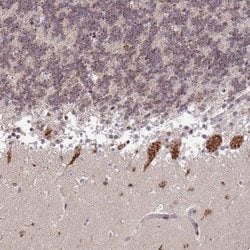 Invitrogen TMEM246 Polyclonal Antibody 100 &mu;L | Buy Online | Invitrogen&trade; | Fisher Scientific