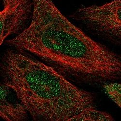 Invitrogen FAM46C Polyclonal Antibody 100 &mu;L; Unconjugated:Antibodies,