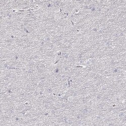 Invitrogen ZP3 Polyclonal Antibody 100 &mu;L; Unconjugated:Antibodies,