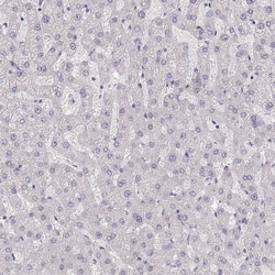 Invitrogen ZP3 Polyclonal Antibody 100 &mu;L; Unconjugated:Antibodies,