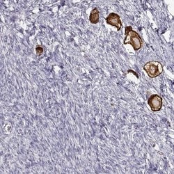 Invitrogen ZP3 Polyclonal Antibody 100 &mu;L; Unconjugated:Antibodies,