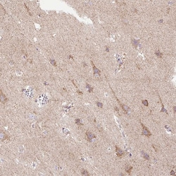 Invitrogen TM2D3 Polyclonal Antibody 100 &mu;L | Buy Online | Invitrogen&trade; | Fisher Scientific