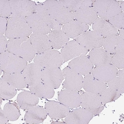 Invitrogen TM2D3 Polyclonal Antibody 100 &mu;L | Buy Online | Invitrogen&trade; | Fisher Scientific