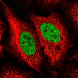 Invitrogen NEIL1 Polyclonal Antibody 100 &mu;L; Unconjugated:Antibodies,