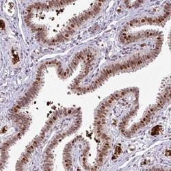 Invitrogen NEIL1 Polyclonal Antibody 100 &mu;L; Unconjugated:Antibodies,