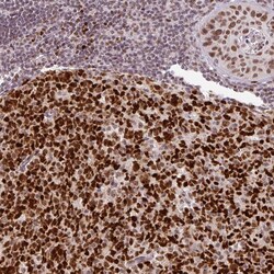 Invitrogen NEIL1 Polyclonal Antibody 100 &mu;L; Unconjugated:Antibodies,