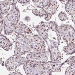 Invitrogen NEIL1 Polyclonal Antibody 100 &mu;L; Unconjugated:Antibodies,