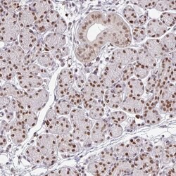 Invitrogen NEIL1 Polyclonal Antibody 100 &mu;L; Unconjugated:Antibodies,