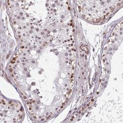 Invitrogen ZNF689 Polyclonal Antibody 100 &mu;L; Unconjugated:Antibodies,