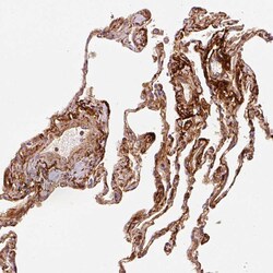 Invitrogen MFAP4 Polyclonal Antibody 100 &mu;L; Unconjugated:Antibodies,