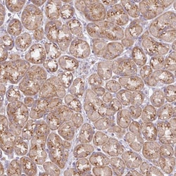 Invitrogen VTI1A Polyclonal Antibody 100 μL; Unconjugated:Antibodies,