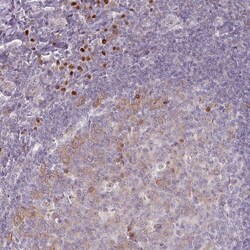 Invitrogen ZBTB6 Polyclonal Antibody 100 &mu;L; Unconjugated:Antibodies,