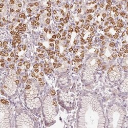 Invitrogen TOB2 Polyclonal Antibody 100 &mu;L | Buy Online | Invitrogen&trade; | Fisher Scientific