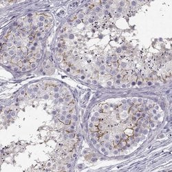 Invitrogen SLCO6A1 Polyclonal Antibody 100 &mu;L; Unconjugated:Antibodies,