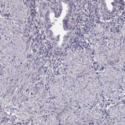 Invitrogen SLCO6A1 Polyclonal Antibody 100 &mu;L; Unconjugated:Antibodies,