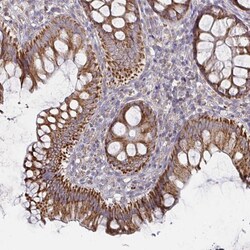 Invitrogen RNF144B Polyclonal Antibody 100 &mu;L; Unconjugated:Antibodies,