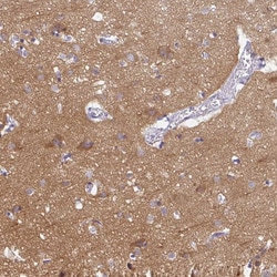 Invitrogen PPFIA4 Polyclonal Antibody 100 &mu;L; Unconjugated:Antibodies,