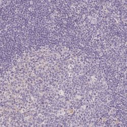 Invitrogen PPFIA4 Polyclonal Antibody 100 &mu;L; Unconjugated:Antibodies,