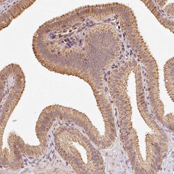 Invitrogen RAB35 Polyclonal Antibody 100 &mu;L; Unconjugated:Antibodies,