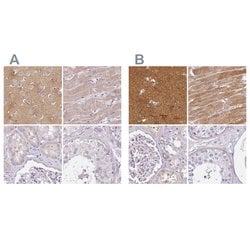 CAP2 Polyclonal Antibody, Invitrogen 100 &mu;L; Unconjugated:Antibodies,