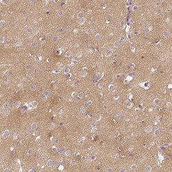CAP2 Polyclonal Antibody, Invitrogen 100 &mu;L; Unconjugated:Antibodies,