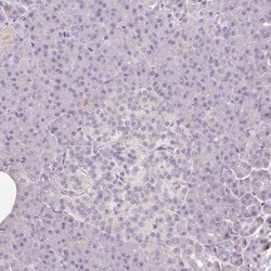CAP2 Polyclonal Antibody, Invitrogen 100 &mu;L; Unconjugated:Antibodies,