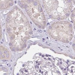 CAP2 Polyclonal Antibody, Invitrogen 100 &mu;L; Unconjugated:Antibodies,