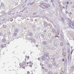 CAP2 Polyclonal Antibody, Invitrogen 100 &mu;L; Unconjugated:Antibodies,