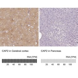 CAP2 Polyclonal Antibody, Invitrogen 100 &mu;L; Unconjugated:Antibodies,