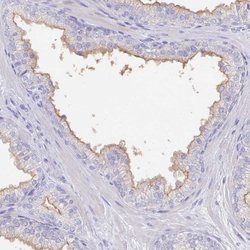 Invitrogen SLC44A4 Polyclonal Antibody 100 &mu;L; Unconjugated:Antibodies,