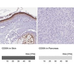 Invitrogen CDSN Polyclonal Antibody 100 &mu;L; Unconjugated:Antibodies,