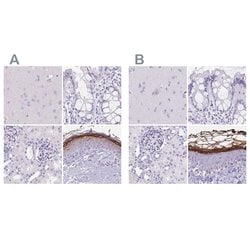 Invitrogen CDSN Polyclonal Antibody 100 &mu;L; Unconjugated:Antibodies,