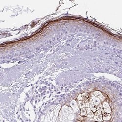 Invitrogen CDSN Polyclonal Antibody 100 &mu;L; Unconjugated:Antibodies,