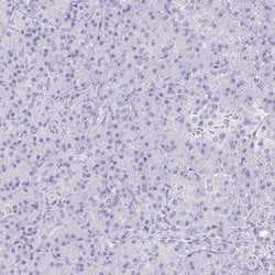 Invitrogen CDSN Polyclonal Antibody 100 &mu;L; Unconjugated:Antibodies,