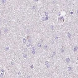 Invitrogen CDSN Polyclonal Antibody 100 &mu;L; Unconjugated:Antibodies,